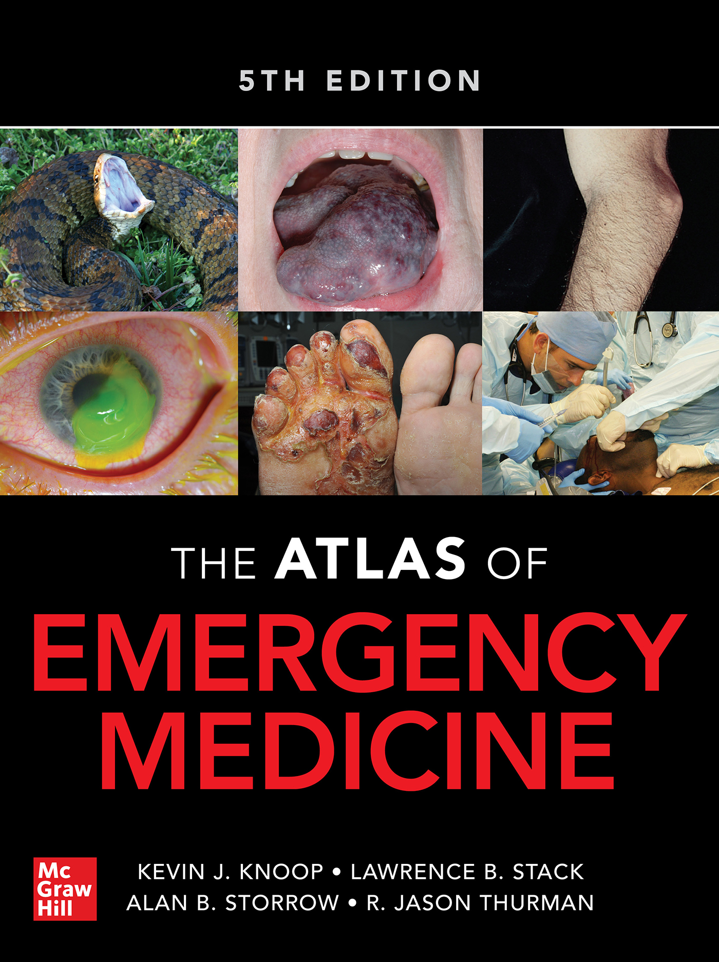 Atlas of Emergency Medicine 5e 2023 - Kevin J. Knoop